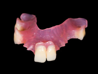 Removable prosthesis