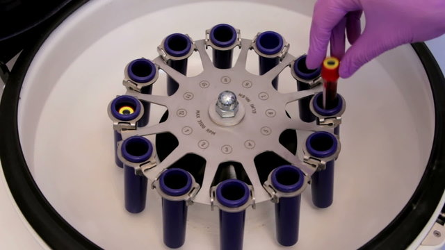Medical laboratory centrifuge