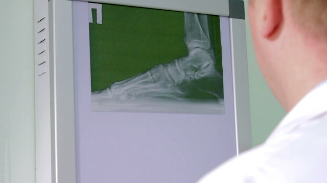 Doctor examines an X-ray of the foot