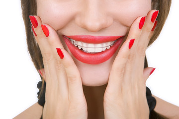 Naklejka premium Beautiful smiling girl with retainer for teeth, close-up