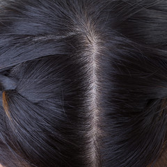 black hair with dandruff on head, close-up image