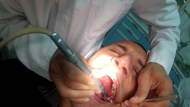 dentist is drilling tooth at stomatolog ordination