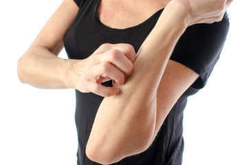 Woman scratching her arm