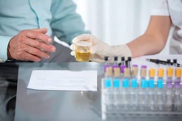 Fototapeta premium Doctor passes urine cups to patients