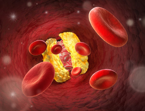 Arterie mit Enpass