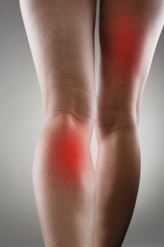Injured female legs with red spots. Muscle strain and stretch.