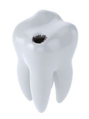 Tooth with black hole caries
