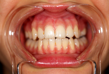 Dental examination