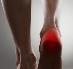 Female heel. Sole pain, treatment and care.