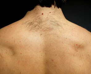 Naklejka premium A man from hairs on the back