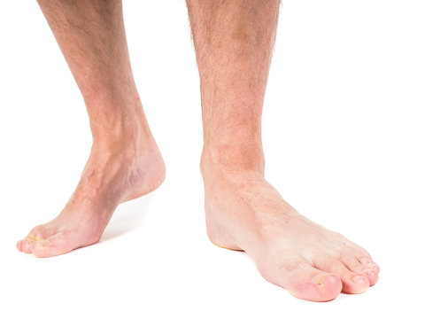 Male person with hairy legs, walking barefooted