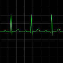 Electrocardiogram