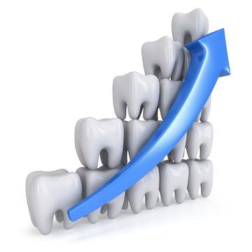 3d teeth bar graph with blue arrow