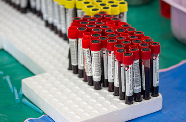 test tubes with blood on a tray