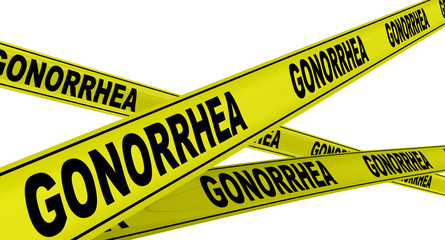 Гонорея (gonorrhea). Желтая оградительная лента