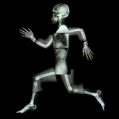 Fototapeta na wymiar Aerobic Exercise (human bone is running) ,(Whole body x-ray )