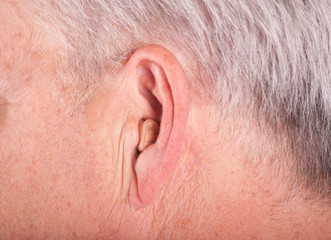 Fototapeta premium Cic hearing aid in the ear