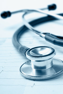 A blue stethoscope on a cardiogram