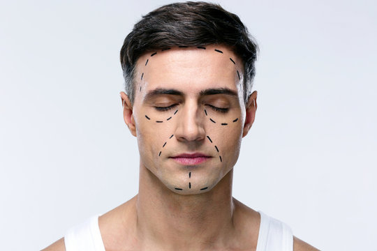 Man with closed eyes and marked with lines for plastic surgery
