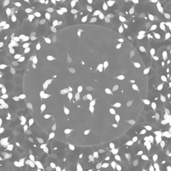 Bacteria under microscope