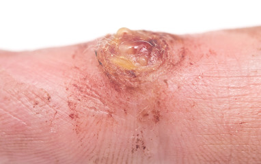 Fototapeta premium wart
