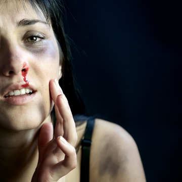 Woman with blood and bruises feeling pain after violence