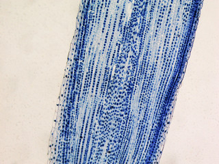 Cells mitosis micrograph