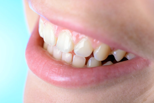 Gepflegte Zähne und Zahnreihen