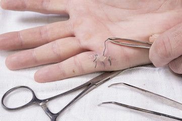 Close up of removing medical thread from wound