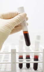 examination blood samples