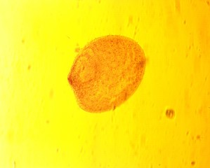 Opalina ranarum - permanent slide plate under high magnification