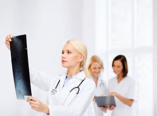 serious female doctor looking at x-ray