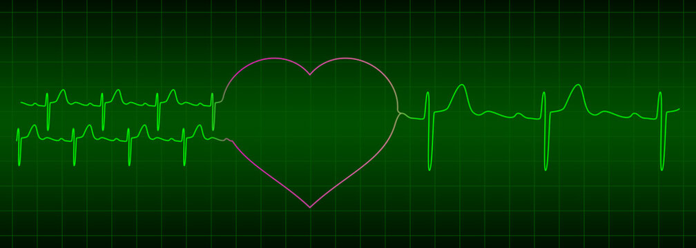 two ekg signals from two hearts after love is one heartbeat