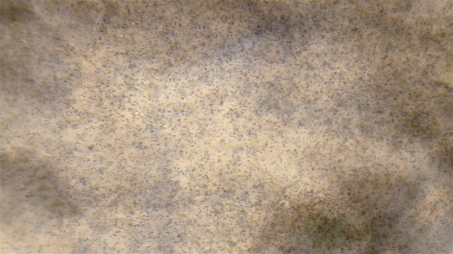 Sperm under microscope. Sequence