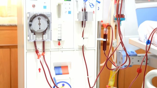 The process of dialysis,hemodialysis machine