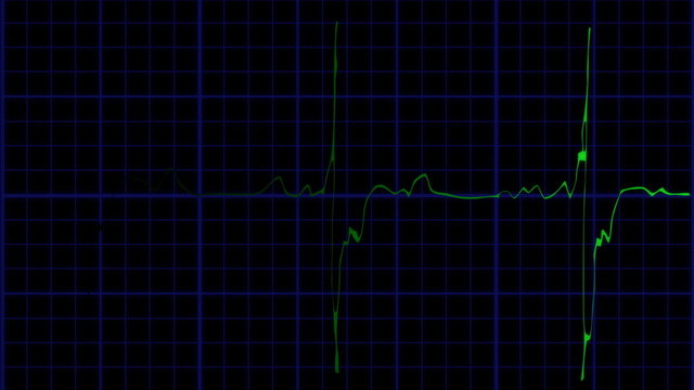 EKG true to life green on blue loopable