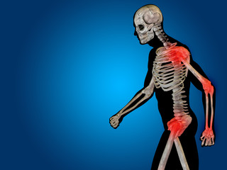 Conceptual human body anatomy pain on blue