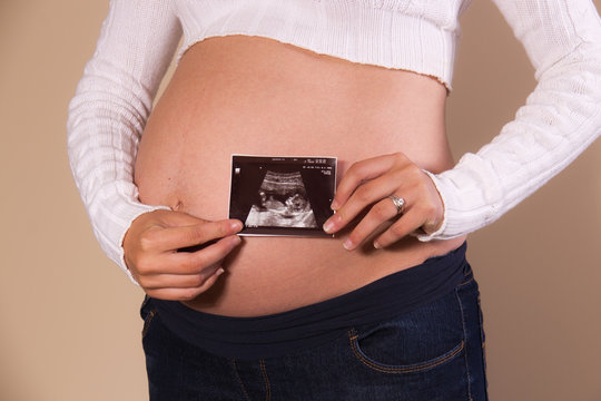 Pregnant woman holding an ultrasound photo on her exposed belly