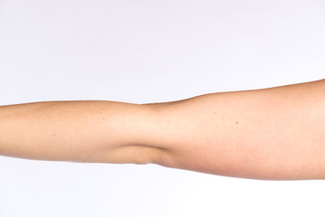 Linker Ellenbogen einer Frau