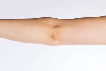 Ellenbogen einer Frau