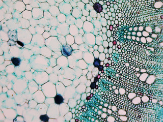 Cotton stem micrograph