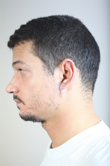Naklejka premium Stitches on man face