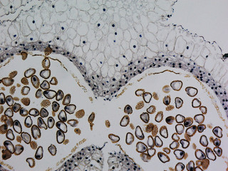 Lily anther micrograph © Claudio Divizia