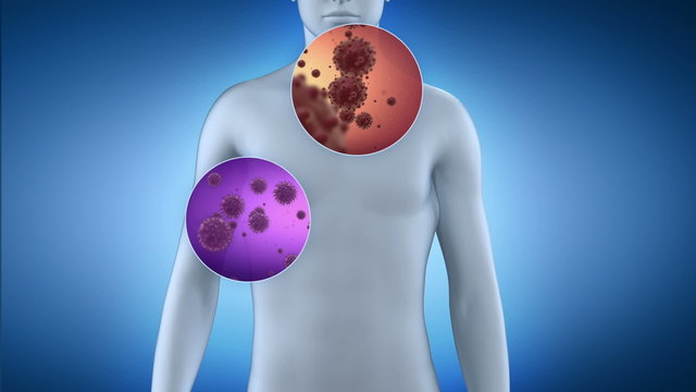 Various bacteria attacking on human body