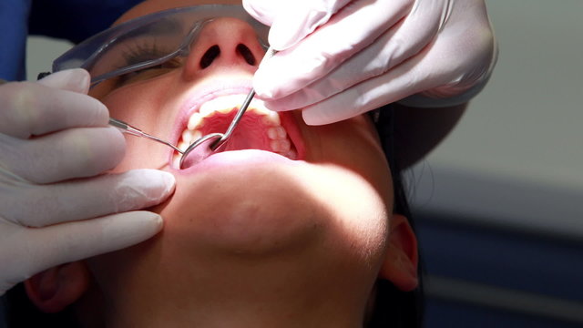 Dentist examining a patients teeth in the dentists chair
