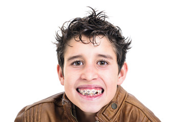 Closeup of a smiling boy with braces