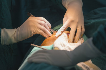 Obraz premium surgeon prepare for skin incision