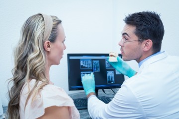 Fototapeta premium Dentist showing woman prosthesis teeth