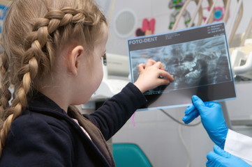 the doctor showing baby foto dent on the clinic - 76142257