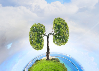Air pollution